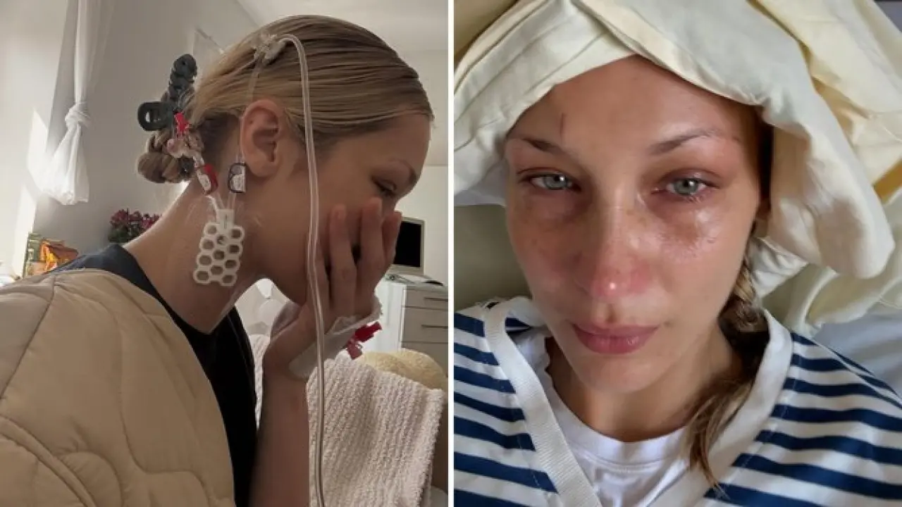 Dünyaca ünlü model Bella Hadid'den ruh sağlığı çağrısı! 2