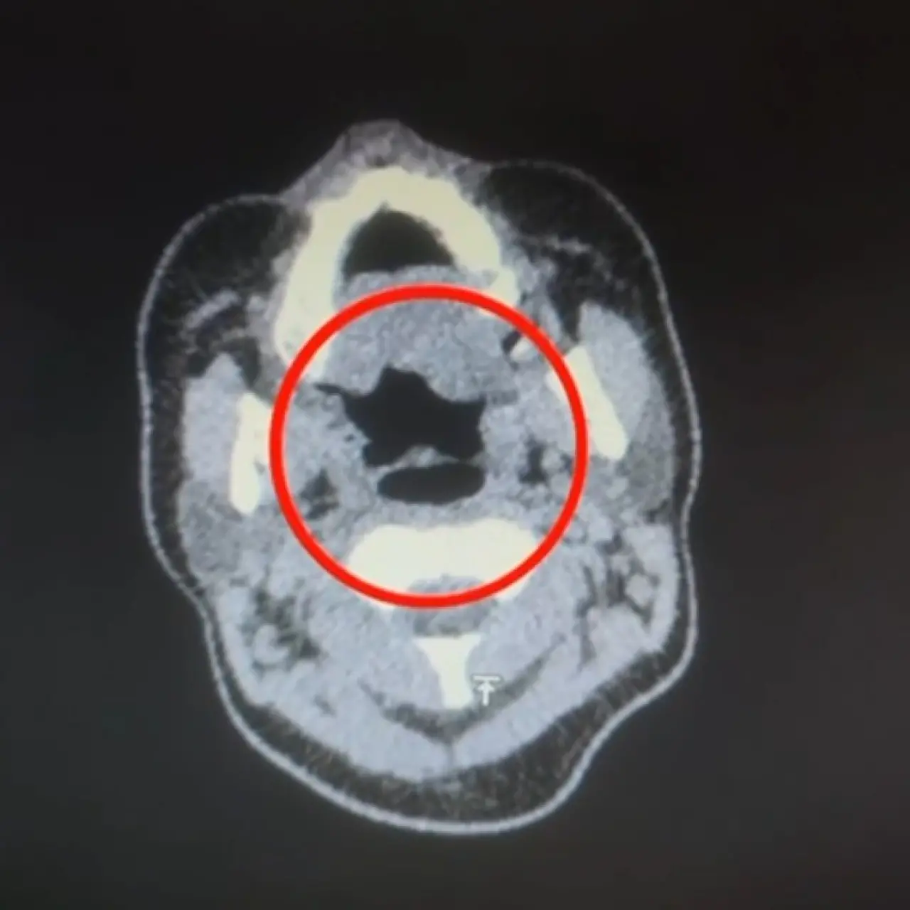 Mideyi cephaneliğe çevirmiş! Şeytani plan çökertildi 2