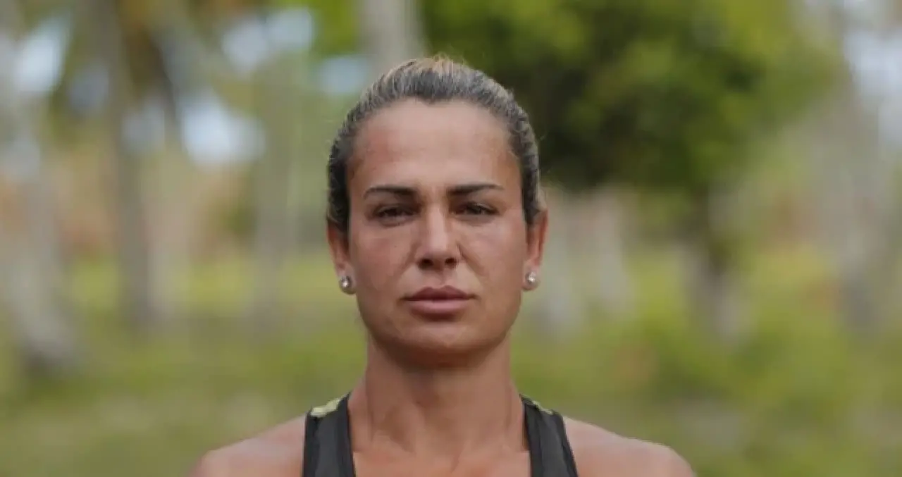 Survivor Nagihan'ın estetikli hali herkesi şaşırttı! 2
