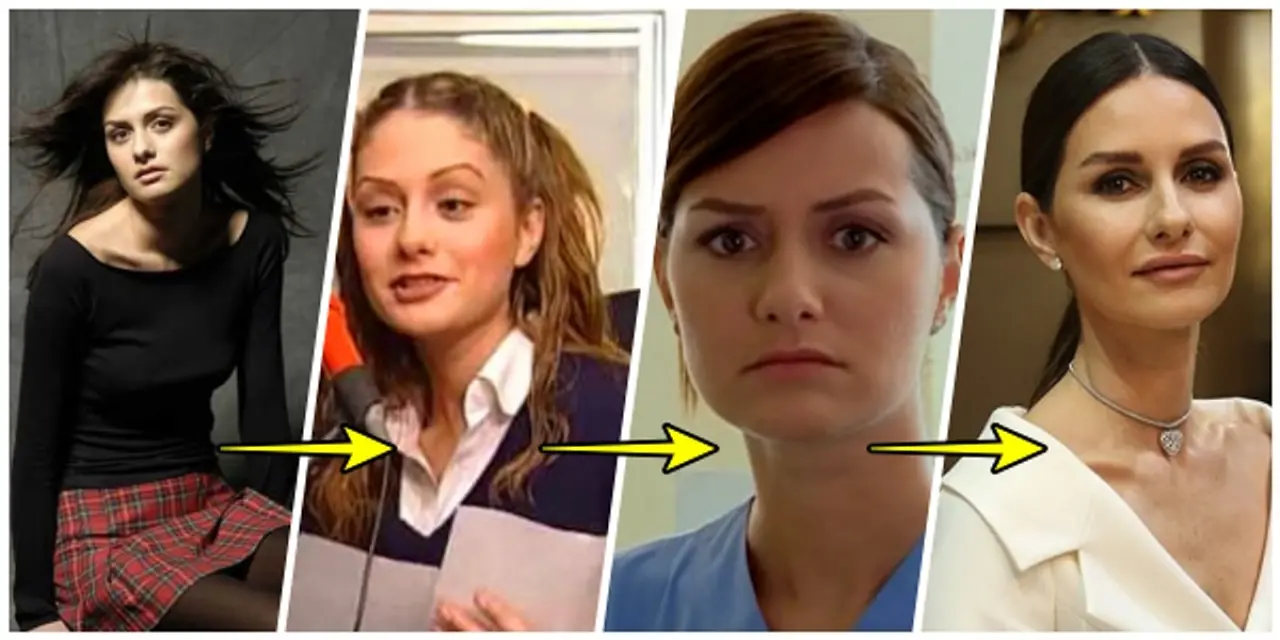 Yasemin Ergene’nin estetikleri gündem oldu! Uzman isim değişimi tek tek açıkladı... 1