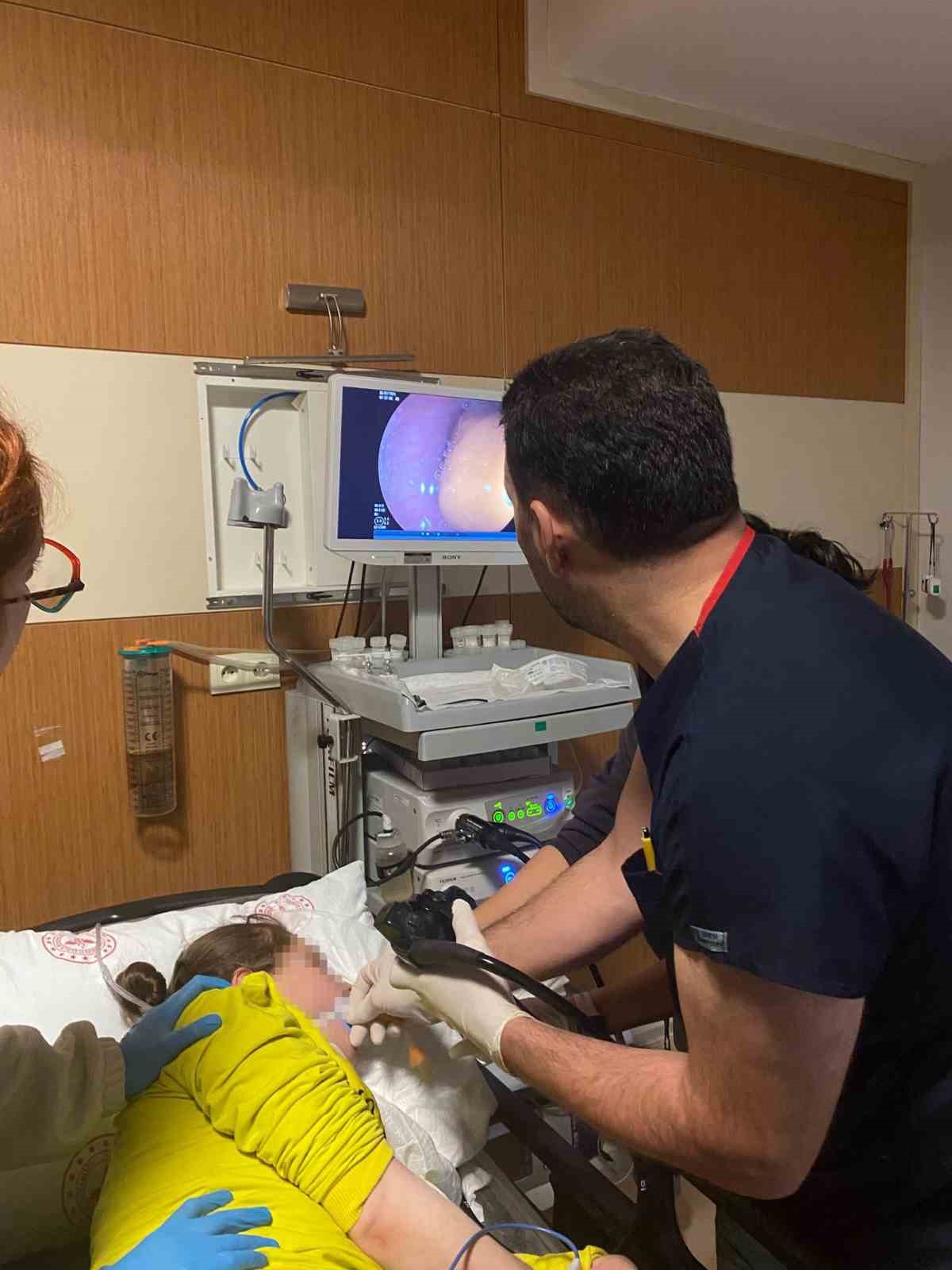 agrida-yuttugu-ceviz-yemek-borusundan-cikarildi