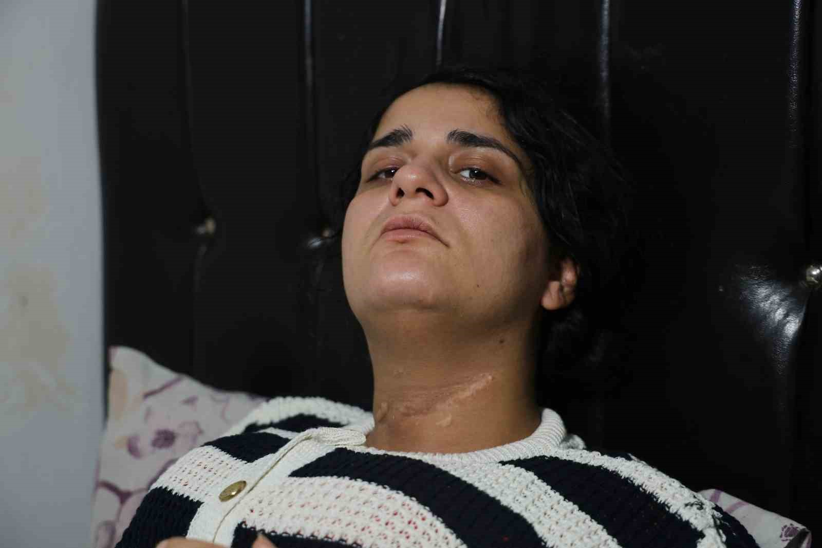 esi-bogazini-kesti-engelli-kaldi-2-cocuk-annesi-dehset-anlarini-ilk-kez-anlatti