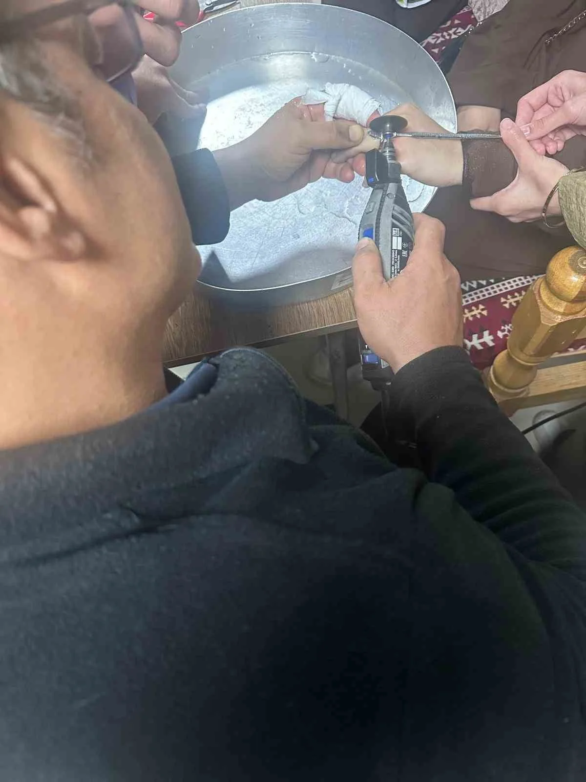 BATMAN'DA BİR VATANDAŞIN PARMAĞINA SIKIŞAN YÜZÜK DOKTOR GÖZETİMİNDE İTFAİYE EKİPLERİNİN...