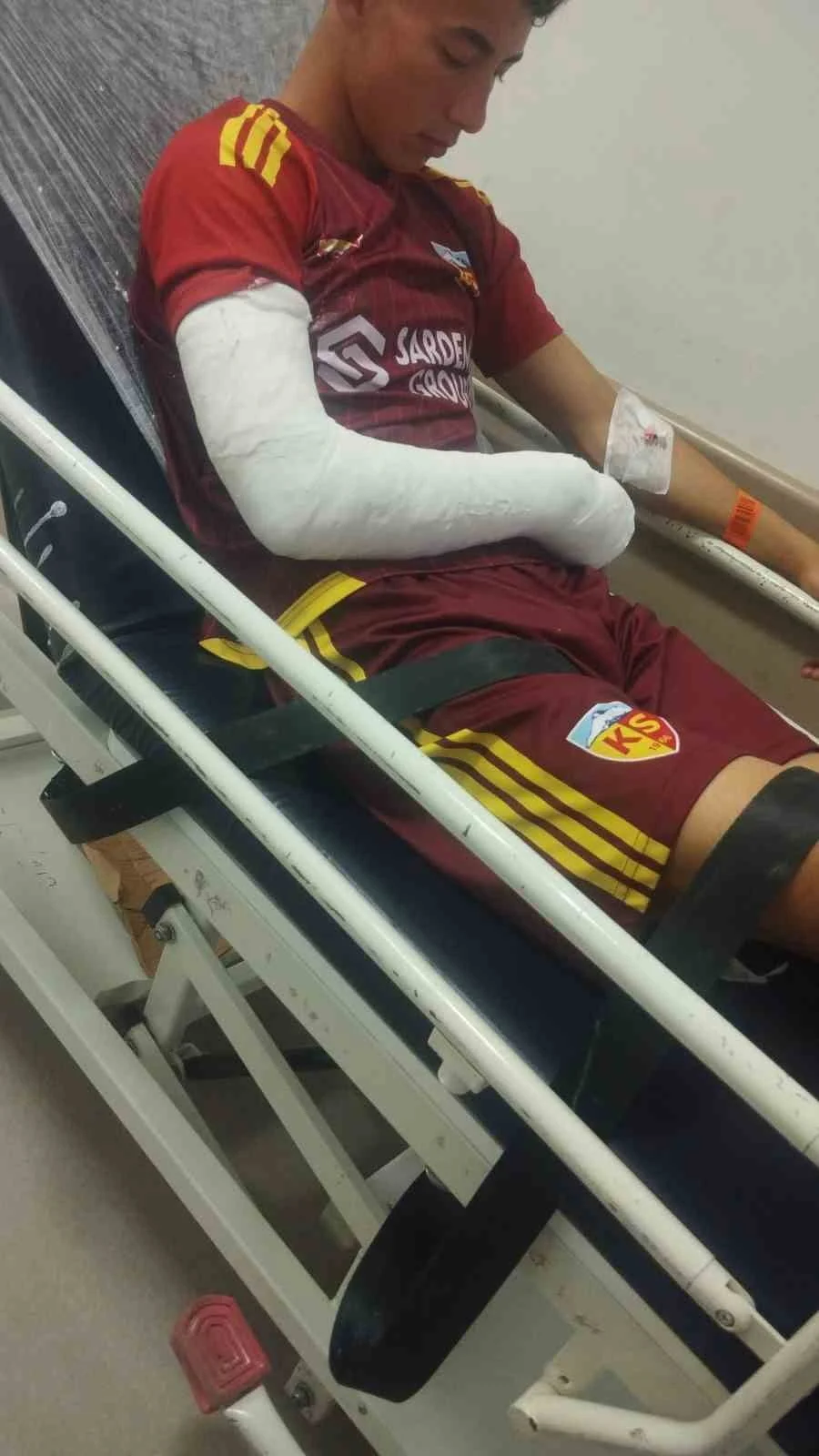 KAYSERİSPOR U19 TAKIMININ BAŞARILI OYUNCUSU HİLMİ TÜRKAN’IN HATAYSPOR MAÇINDA KOLU KIRILDI.